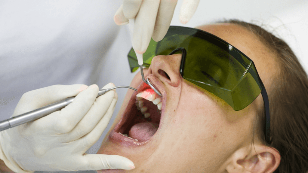 What is Full Mouth Flap Surgery with Laser?