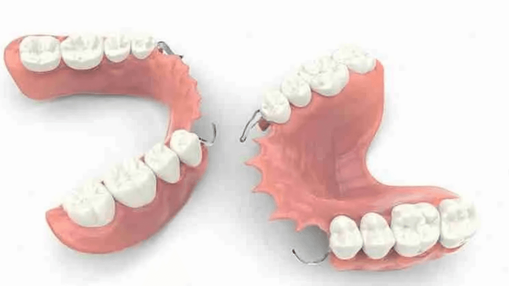 Why Choose Tooth N Implants Dental Clinic for Your RPD Needs?